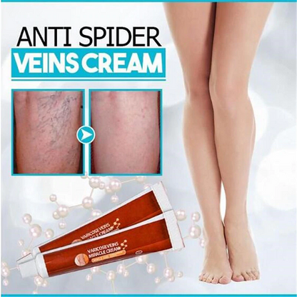 Varicose Veins Miracle Cream 1