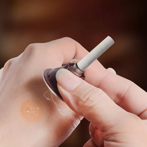 Acupoint Body Acupuncture 1
