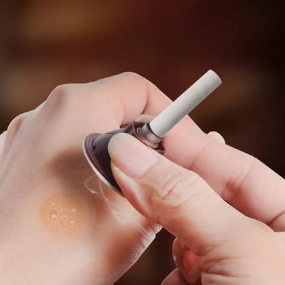 Acupoint Body Acupuncture 1