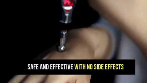 Acupuncture Pen 1