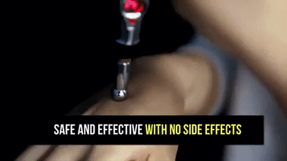 Acupuncture Pen 1