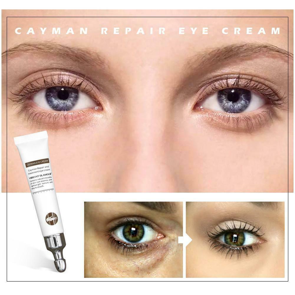 Magic Eye Cream 1