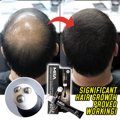 Scalp Intense  Roll-on Hair Growth Serum 1