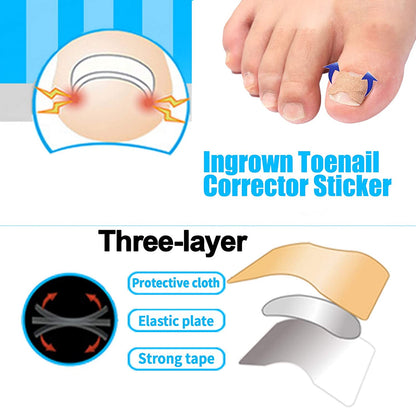 Ingrown Toenail Corrector Patches 1