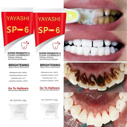 Toothpaste Oral Health Management 1