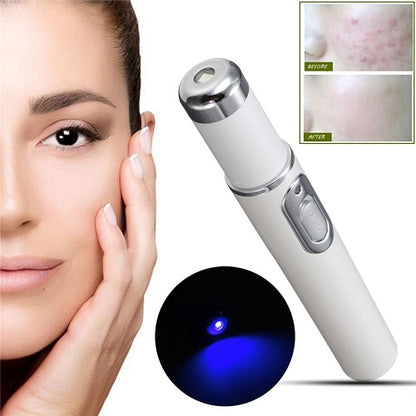 Light Therapy Acne Pen 1